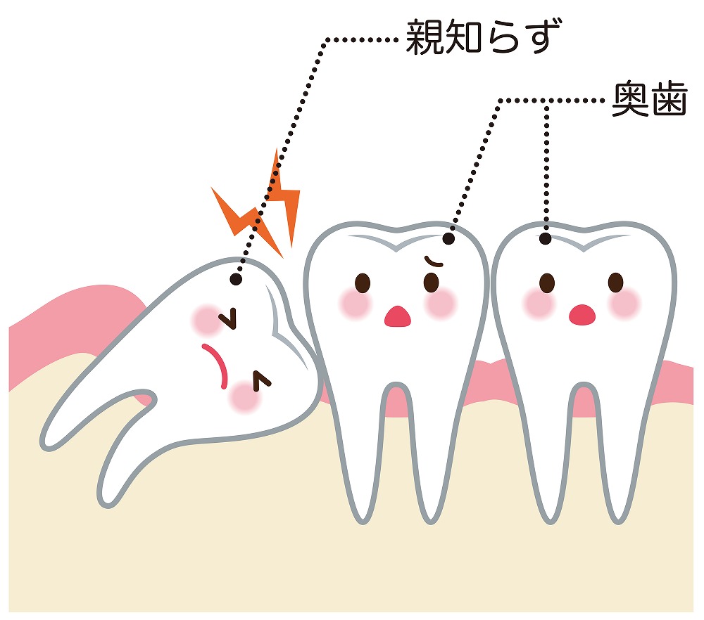 親知らずについて