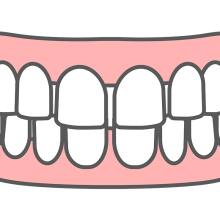 空隙歯列・すきっ歯